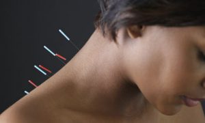 acupuncture asheville