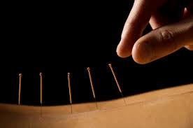 Acupuncture Resources