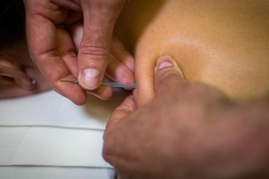blue_ridge_clinic_acupuncture