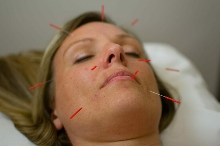 Anti Aging and Acupuncture in Asheville…