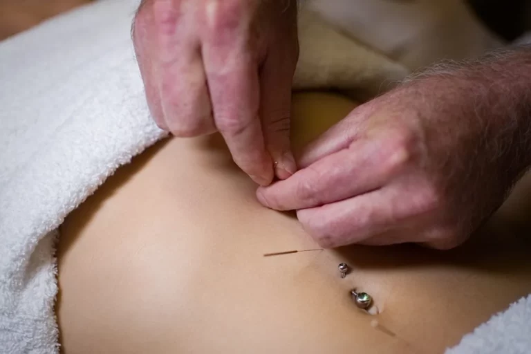 Treating Gallstones with Acupuncture
