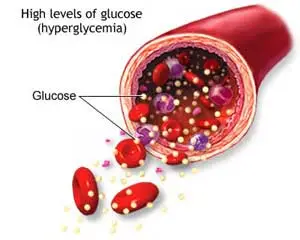 High Blood Sugar and Acupuncture